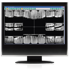 Digital Dental X-Ray