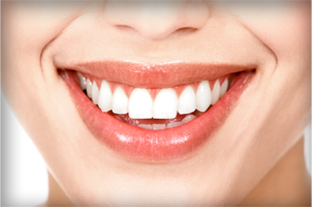 Smile Makeover