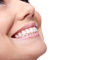 Teeth Whitening